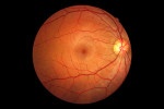 Can the Macula Be Repaired? featured image