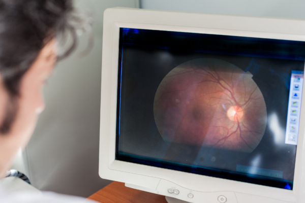Retinal Detachment: Causes, Signs, and Emergency Treatment featured image